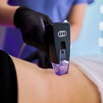 RF vs HIFU: что на самом деле определяет глубину воздействия и какая технология даёт управляемый лифтинг?